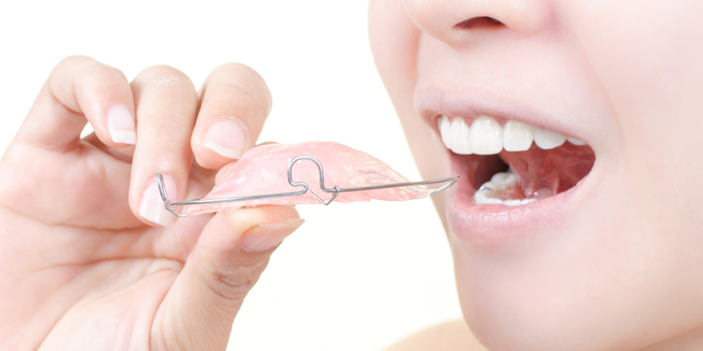 Ortodonzia_Apparecchi_Mobili 1000x500 Ortodonzia Apparecchio mobile rimovibile Studio Bianconi dentista Bolzano