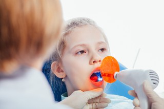 Lampada alogena fotopolimerizzante per odontoiatria conservativa e indurimento resina da otturazione e sigillatura Studio Bianconi dentista Bolzano