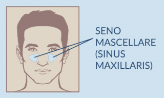 Morfologia e posizionamento del seno mascellare