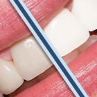 Odonto_Estetica_Sbianca 300x300