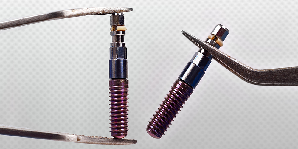 Implantologia Impianti a vite titanio tantalio osteointegrazione Studio Bianconi dentista Bolzano