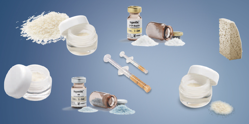 Implantologia_Materiali_innesto 1000x500